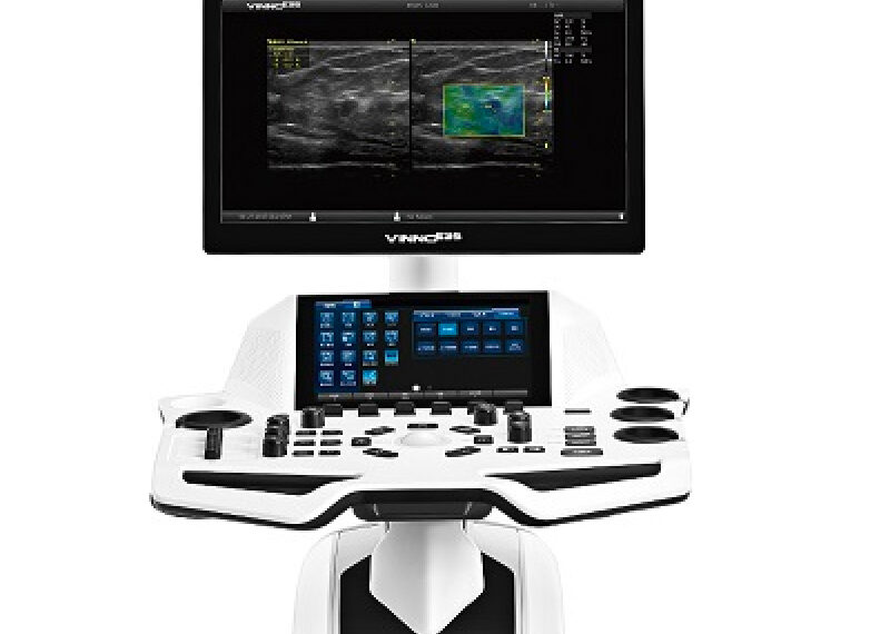 Vinno E35 Ultrasound