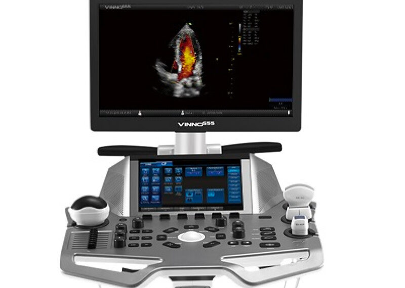 Vinno G55 Ultrasound